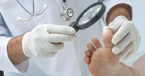 Doctor treats foot fungus
