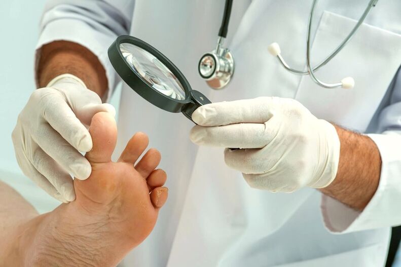 Dermatologist examining toenails