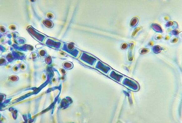 Fungus Trichophyton rubrum under microscope