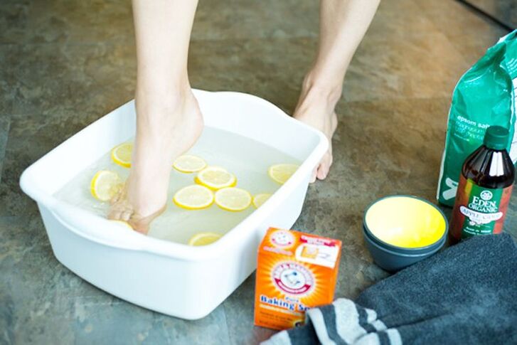 Celandine foot bath to treat onychomycosis