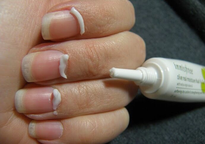 Treat onychomycosis with ointment