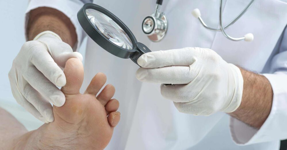 Doctor checks feet for fungus